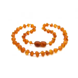 Cognac Amber Necklace Raw Beads